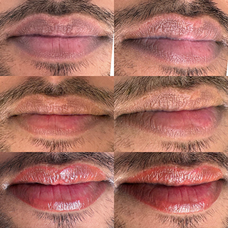 lip neutralization and colour corrections before and-after 01