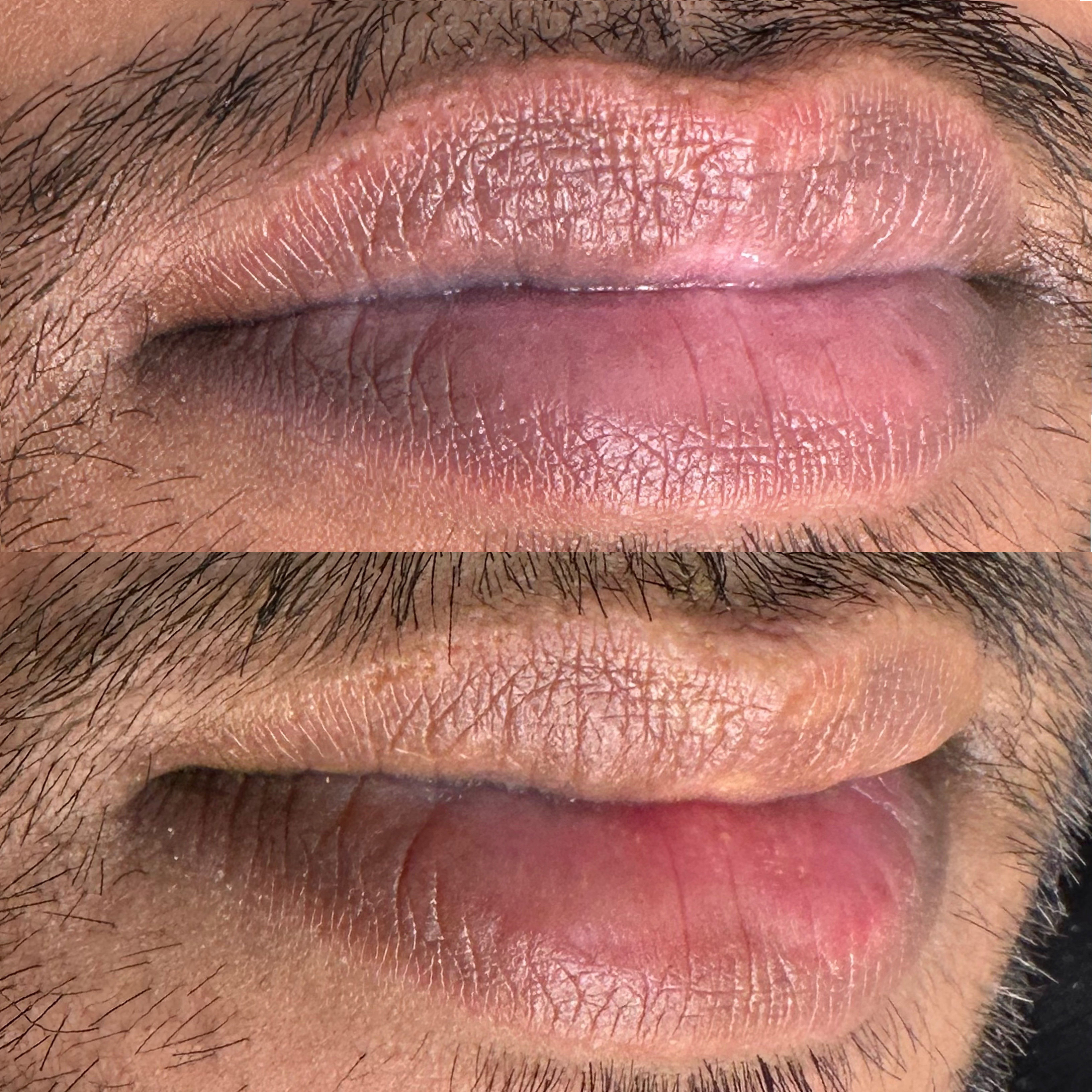 lip neutralization and colour corrections before and-after 02